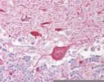 TIGAR Antibody in Immunohistochemistry (IHC)
