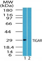 TIGAR Antibody in Western Blot (WB)