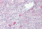 TLR2 Antibody in Immunohistochemistry (Paraffin) (IHC (P))