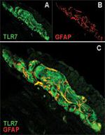 TLR7 Antibody in Immunocytochemistry (ICC/IF)