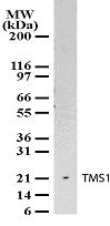 PYCARD Antibody in Western Blot (WB)
