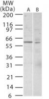 TRF1 Antibody in Western Blot (WB)