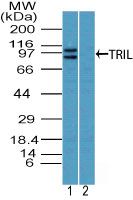 TRIL Antibody in Western Blot (WB)