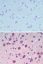 UCP4 Antibody in Immunohistochemistry (Paraffin) (IHC (P))