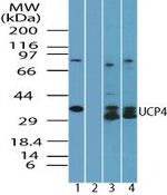 UCP4 Antibody in Western Blot (WB)