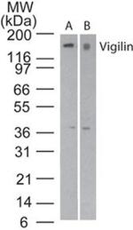 HDLBP Antibody in Western Blot (WB)