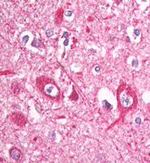 eIF3b Antibody in Immunohistochemistry (Paraffin) (IHC (P))