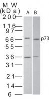 p73 Antibody in Western Blot (WB)