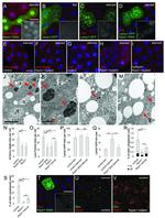 GFP Antibody in Immunocytochemistry (ICC/IF)