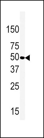 beta-2 Adrenergic Receptor Antibody in Western Blot (WB)