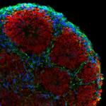 beta-3 Tubulin Antibody in Immunohistochemistry (Frozen) (IHC (F))