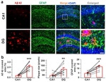 beta Amyloid Antibody in Immunohistochemistry (IHC)