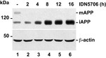 beta Amyloid Antibody in Western Blot (WB)