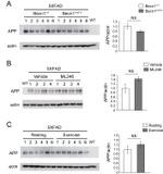 beta Amyloid Antibody in Western Blot (WB)