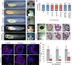 HuC/HuD Antibody in Immunohistochemistry (IHC)