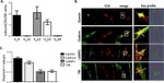 Transferrin Receptor Antibody in Immunocytochemistry (ICC/IF)