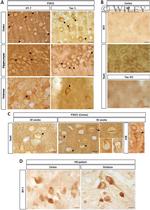Tau Antibody in Immunohistochemistry (Paraffin) (IHC (P))