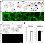 Tau Antibody in Immunohistochemistry (Paraffin) (IHC (P))