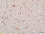 TSHR Antibody in Immunohistochemistry (Paraffin) (IHC (P))