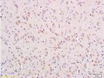 Nestin Antibody in Immunohistochemistry (Paraffin) (IHC (P))