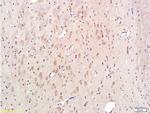 Cytochrome C Antibody in Immunohistochemistry (Paraffin) (IHC (P))