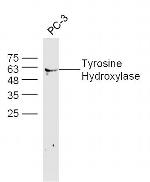 Tyrosine Hydroxylase Antibody in Western Blot (WB)