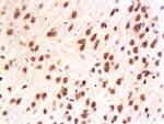 ERK1/ERK2 Antibody in Immunohistochemistry (Paraffin) (IHC (P))