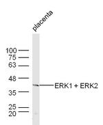 ERK1/ERK2 Antibody in Western Blot (WB)