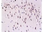 Calcineurin A Antibody in Immunohistochemistry (Paraffin) (IHC (P))