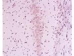 Calcineurin A Antibody in Immunohistochemistry (Paraffin) (IHC (P))