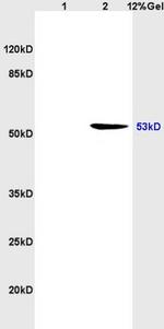 P53 proteinwt-p53 Antibody in Western Blot (WB)