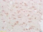 Phospho-CREB-1 (Ser133) Antibody in Immunohistochemistry (Paraffin) (IHC (P))