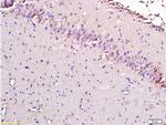 AIF Antibody in Immunohistochemistry (Paraffin) (IHC (P))