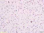 Caspase-9 Antibody in Immunohistochemistry (Paraffin) (IHC (P))