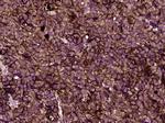 MLANA/MART1 Antibody in Immunohistochemistry (Paraffin) (IHC (P))