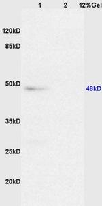 Caspase 8 Antibody in Western Blot (WB)