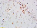 GDNF Receptor alpha 2 Antibody in Immunohistochemistry (Paraffin) (IHC (P))
