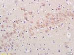 Artemin Antibody in Immunohistochemistry (Paraffin) (IHC (P))