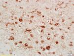 Calretinin Antibody in Immunohistochemistry (Paraffin) (IHC (P))