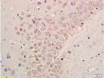 Substance P Antibody in Immunohistochemistry (Paraffin) (IHC (P))