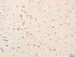 NKB Antibody in Immunohistochemistry (Paraffin) (IHC (P))