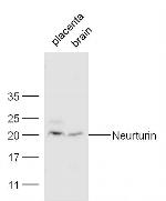 Neurturin Antibody in Western Blot (WB)