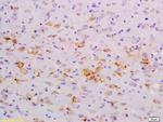 NFkB Inducing Kinase NIK Antibody in Immunohistochemistry (Paraffin) (IHC (P))