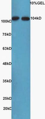 NFkB Inducing Kinase NIK Antibody in Western Blot (WB)