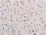 VIP Antibody in Immunohistochemistry (Paraffin) (IHC (P))