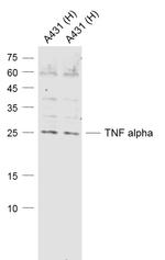 TNF alpha Antibody in Western Blot (WB)