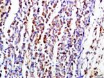 CD19 Antibody in Immunohistochemistry (Paraffin) (IHC (P))