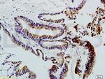 CD20 Antibody in Immunohistochemistry (Paraffin) (IHC (P))