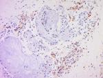CD20 Antibody in Immunohistochemistry (Paraffin) (IHC (P))