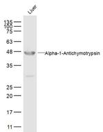 AACT Alpha1 Antibody in Western Blot (WB)